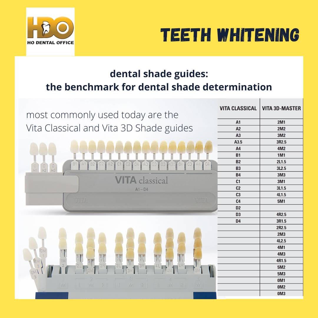 dental shade guides - the benchmark for tooth shade determination