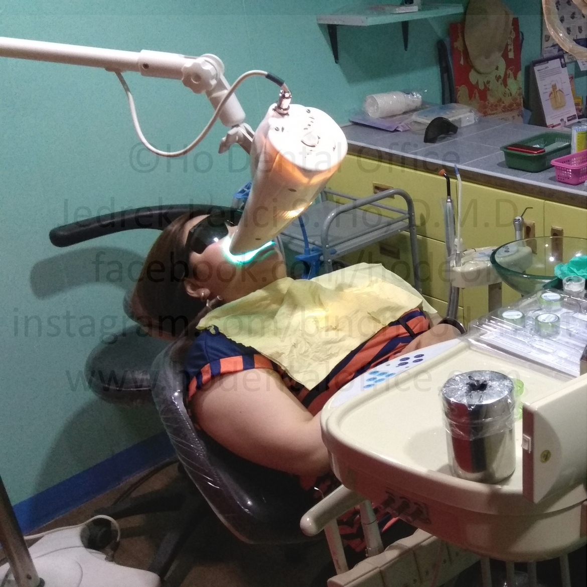 in-office professional teeth whitening