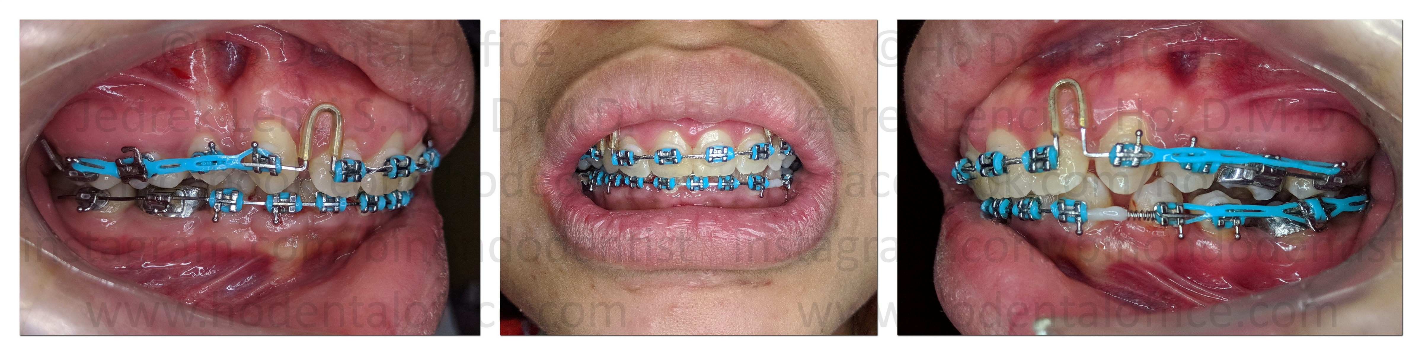 patient's last appointment before pandemic (Feb 27, 2020)